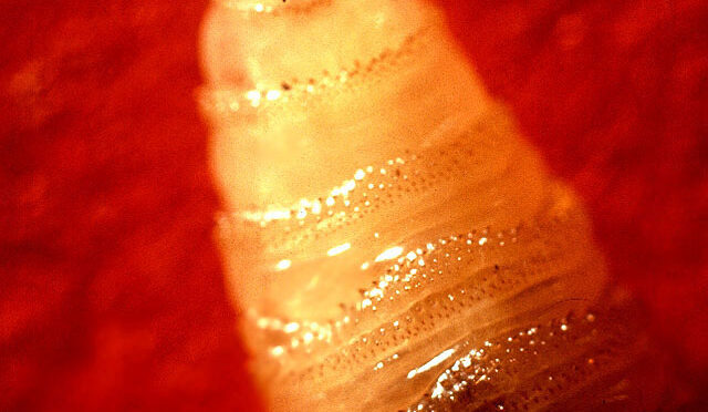 Flesh-Eating Screwworm Is A Huge Threat-And It’s Back In America